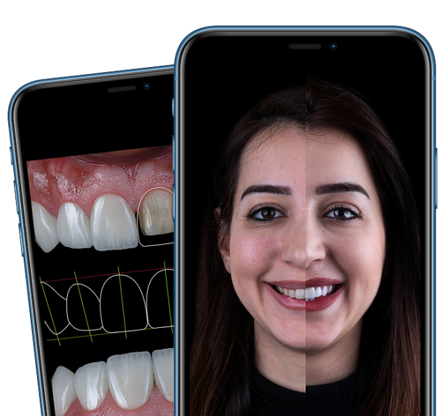 Smiles Family Dental consultation