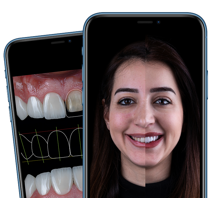 Smiles Family Dental consultation