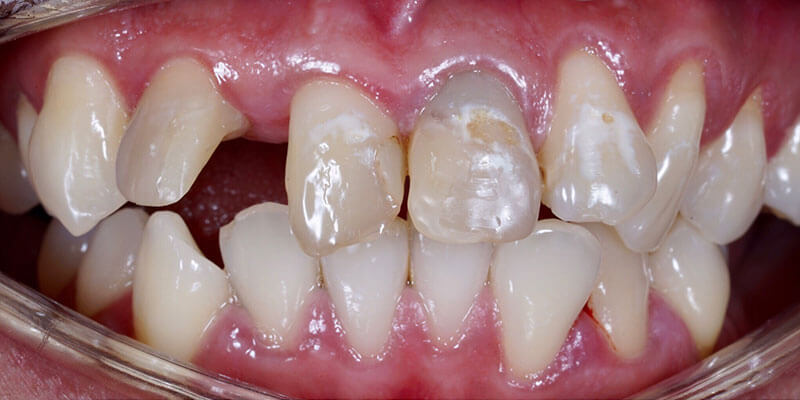 shutterstock_1551804836_before